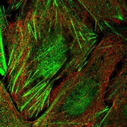 TIGD6 Antibody, Novus Biologicals 25 &mu;L | Buy Online | Novus Biologicals | Fisher Scientific